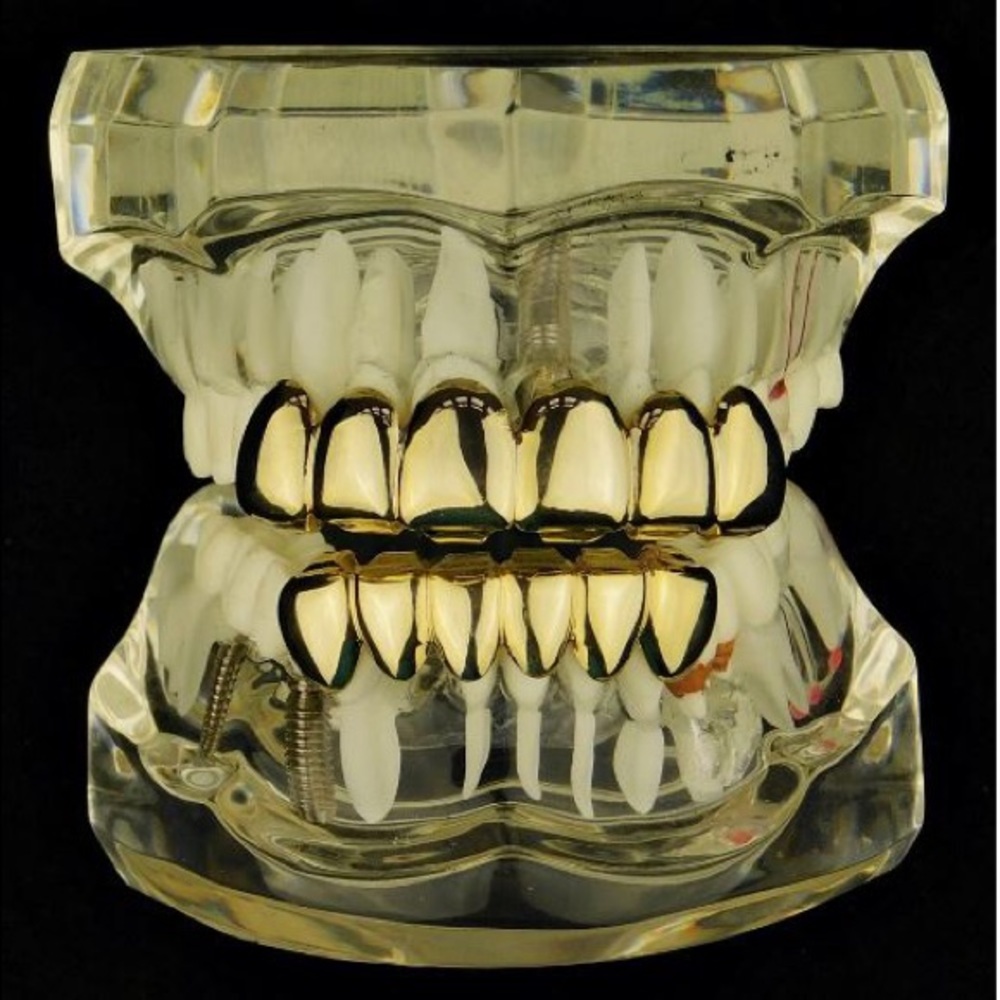 COPY - Grillz 18k Gold Plated Set Top&bottom